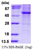 Human HDAC8 Protein (Recombinant His)