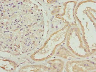 ZNF191 / ZNF24 Antibody