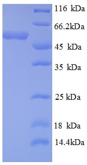 Human DAXX Protein (Recombinant GST)