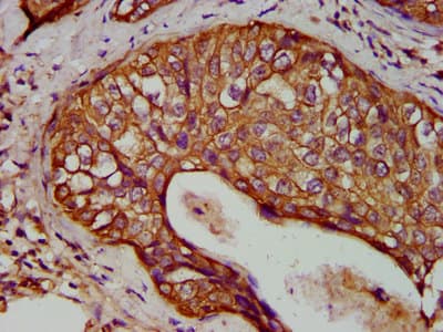 KRT1 / CK1 / Cytokeratin 1 Antibody