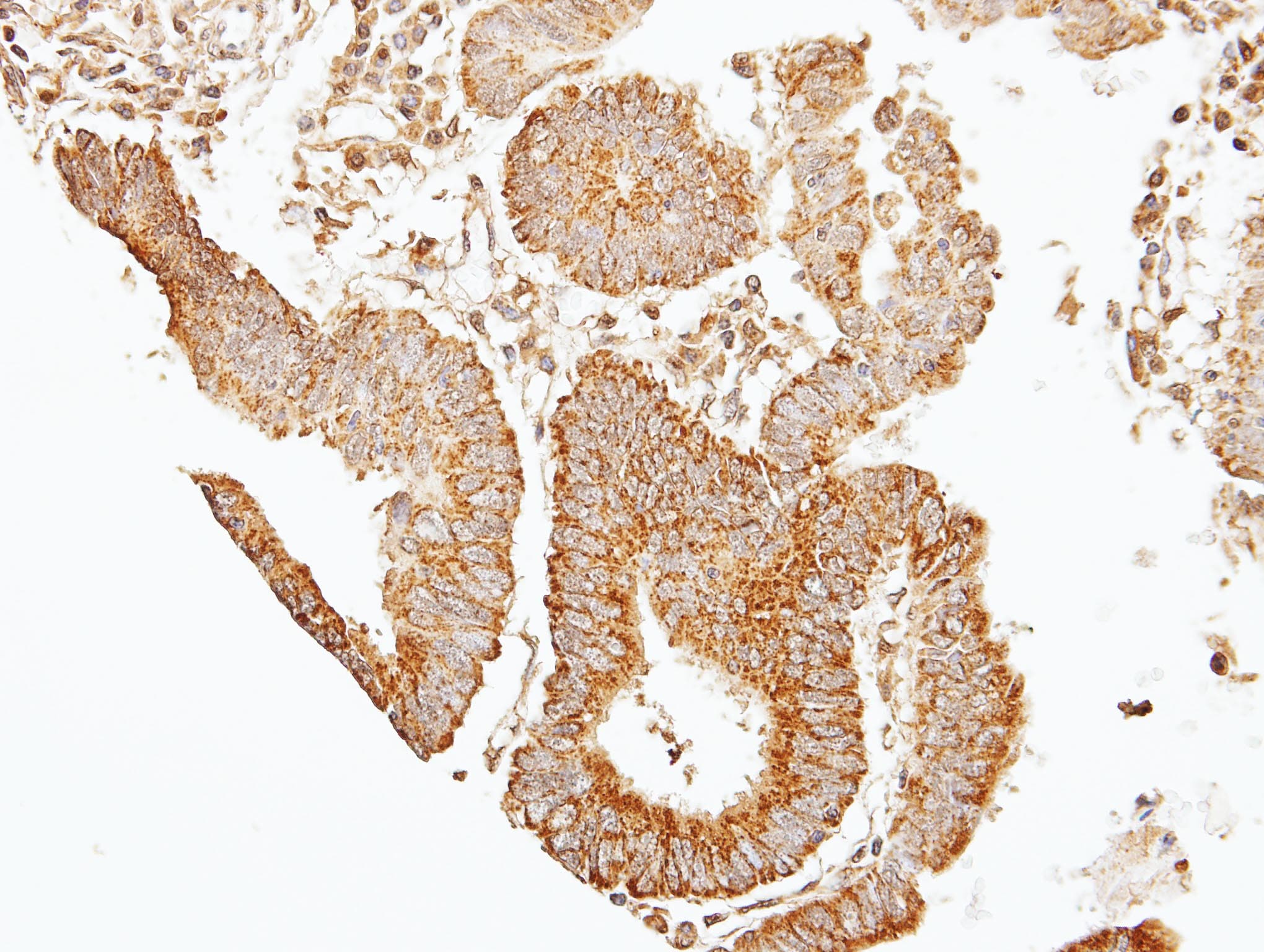 Polyclonal Rabbit anti-Human SEPT7 / Septin 7 Antibody (aa192-437, IHC, WB)