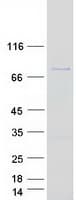 Human SPIRE1 Protein (Recombinant Myc-DDK (Flag))