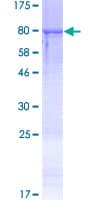 Human RGS11 Protein (Recombinant GST)