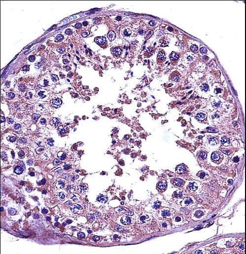 STAT4 Antibody (aa666-695)