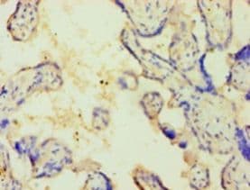 CSNK1E / CK1 Epsilon Antibody (aa1-416)