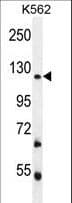 FBRSL1 Antibody (aa906-935)