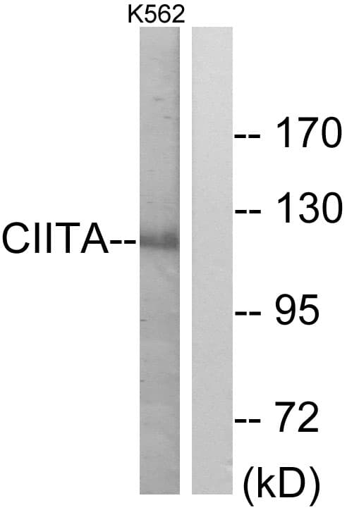 CIITA Antibody (aa706-755)