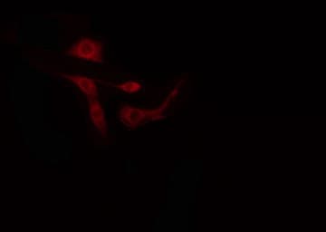 Polyclonal Rabbit anti-Human ARID1B / BAF250B Antibody (IF, WB)