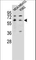 HTR3A / 5-HT3A Receptor Antibody (aa30-58)