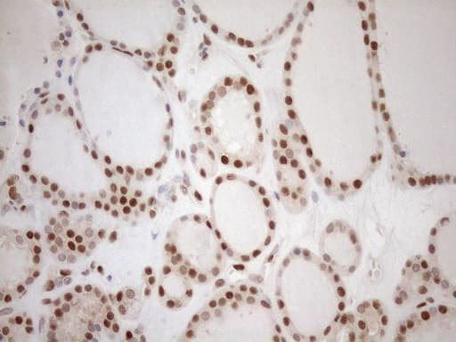MGMT Antibody (clone OTI4F9)