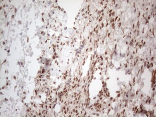 IRS1 Antibody (aa1-280, clone OTI9E11)