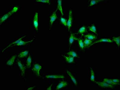 FASLG / Fas Ligand Antibody (aa103-281)