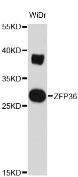 ZFP36 / Tristetraprolin Antibody