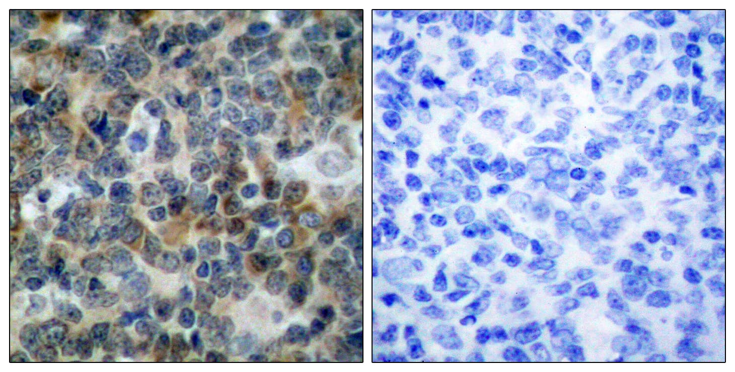 VASP Antibody (phospho-Ser238)