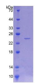 Rat PNPLA6 / NTE Protein (Recombinant His)