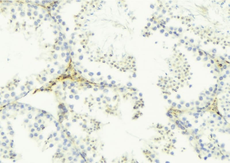FAM3B Antibody