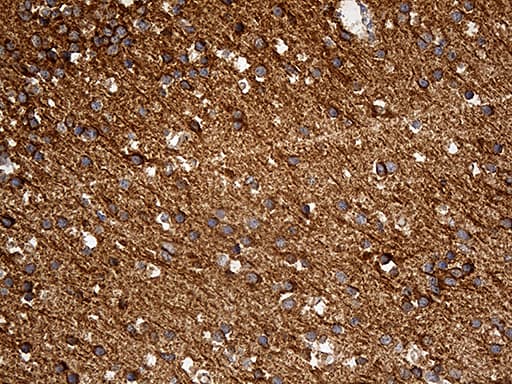 DBN1 / Drebrin Antibody (aa2-240, clone OTI4B3)
