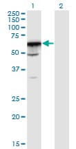 Monoclonal Mouse anti-Human PRPF31 Antibody (clone 8E1, WB)