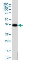 IHC-plus™ GAX / MEOX2 Antibody (clone 6A5)