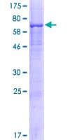 Human PLD5 / Phospholipase D5 Protein (Recombinant GST)
