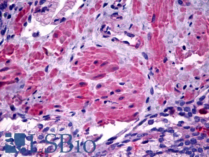 IHC-plus™ Polyclonal Rabbit anti-Human ACTG1 / Gamma Actin Antibody (IHC, WB)
