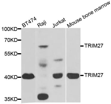 Polyclonal Rabbit anti-Human TRIM27 Antibody (IHC, IF, WB)
