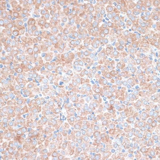 TMEPAI / PMEPA1 Antibody