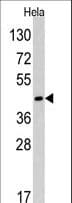 Polyclonal Rabbit anti-Human RAD9A / RAD9 Antibody (aa250-279, WB)