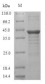 Human UNC119 / Retinal Protein 4 (Recombinant 6His-SUMO, N-terminus)