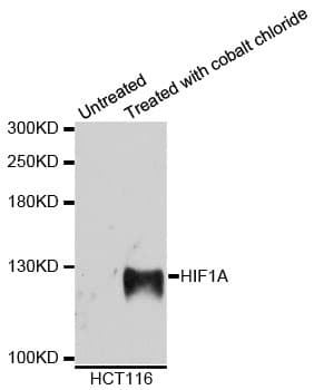 Polyclonal Rabbit anti-Human HIF1A / HIF1 Alpha Antibody (WB)
