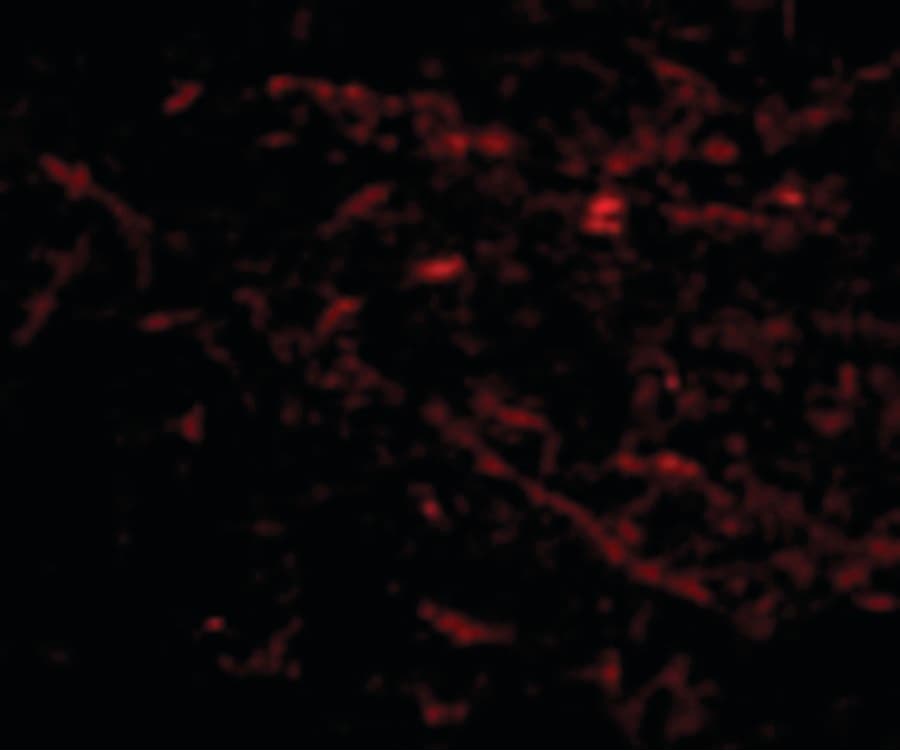IHC-plus™ SIRT2 / Sirtuin 2 Antibody