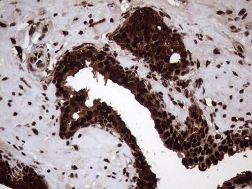 TALDO1 / Transaldolase 1 Antibody (clone OTI2E4)
