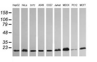 Monoclonal Mouse anti-Human HRAS / H-Ras Antibody (clone OTI1A1, IHC, IF, WB)