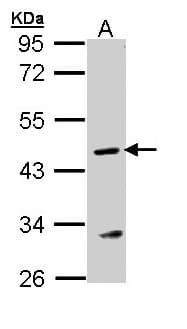 IHC-plus™ ASL / Argininosuccinate Lyase Antibody (aa86-325)