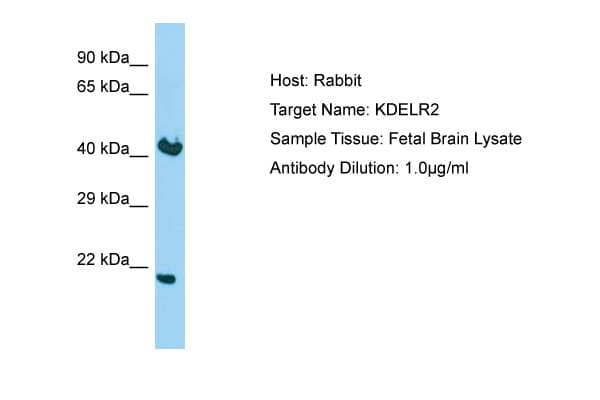 KDELR2 Antibody (C-Terminus)