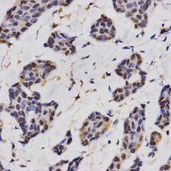 RCAN1 / DSCR1 Antibody