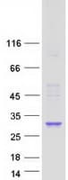 Human PIGL Protein (Recombinant Myc-DDK (Flag))