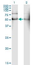 ALDH2 Antibody (clone 1E5)