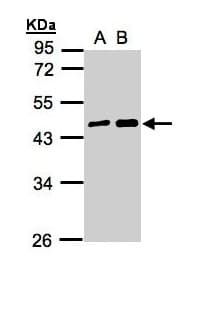 MAGEA11 Antibody (aa78-173)