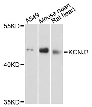 KCNJ2 / Kir2.1 Antibody