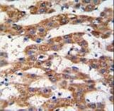 PHB / Prohibitin Antibody (aa89-117)