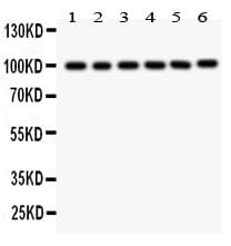 GOK / STIM1 Antibody (aa45-74)