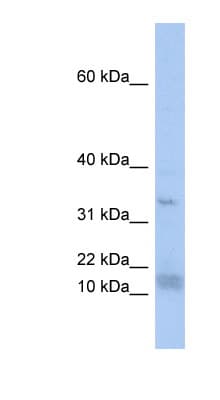 Polyclonal Rabbit anti-Human SF3B6 / SF3B14 Antibody (N-Terminus, WB)