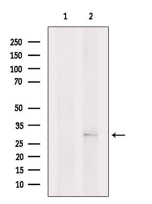 PGAM1 Antibody