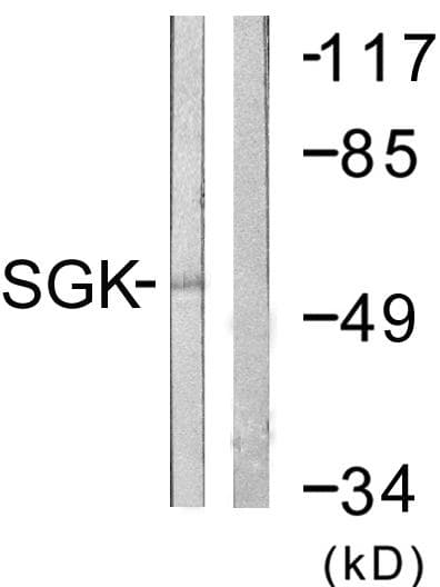 Polyclonal Rabbit anti-Human SGK1 / SGK Antibody (p78, IHC, IF, WB)