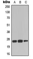 Polyclonal Rabbit anti-Human TNFRSF9 / 4-1BB / CD137 Antibody (aa89-118, IF, WB)