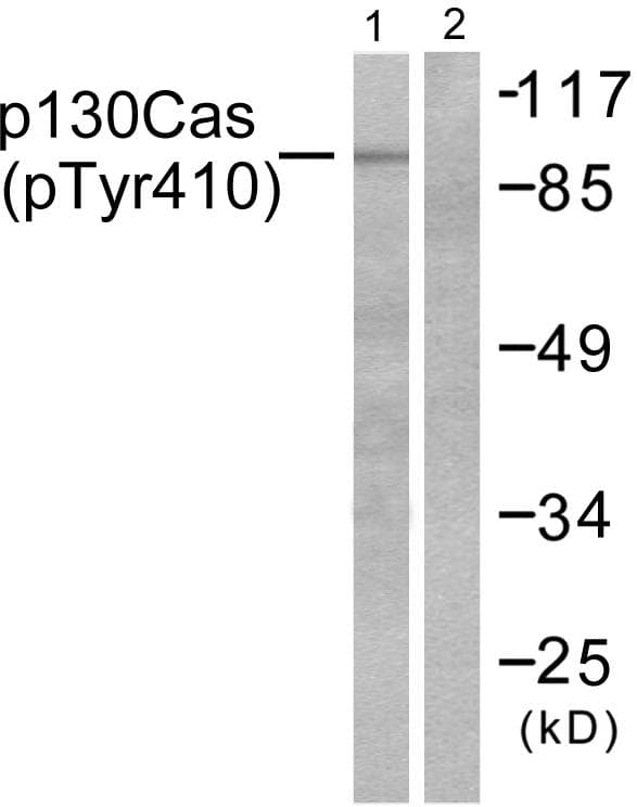 Polyclonal Rabbit anti-Human BCAR1 / p130Cas Antibody (phospho-Tyr410, IHC, WB)