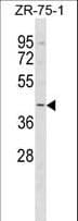 HGH1 / FAM203A Antibody (aa254-280)