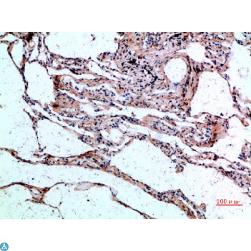 Polyclonal Rabbit anti-Human CTGF Antibody (IHC)