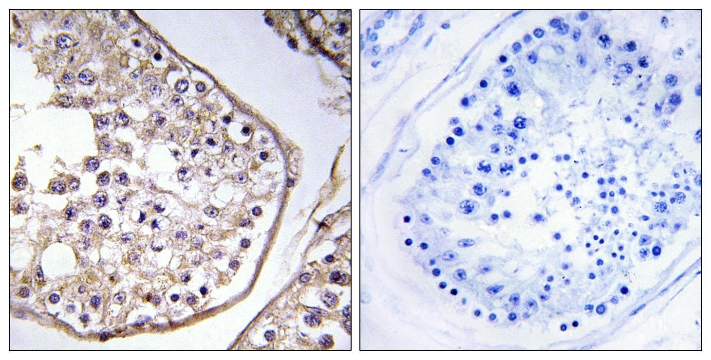 BAGE3 Antibody